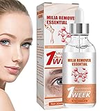 ZIYANG Augenessenz für Augenringe,Feuchtigkeitsspendendes mit Calendula-Essenz |...