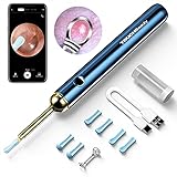 TOUCHBeauty Ohrenschmalz Entferner Otoskop,WiFi Ohrreiniger mit 1080P HD...